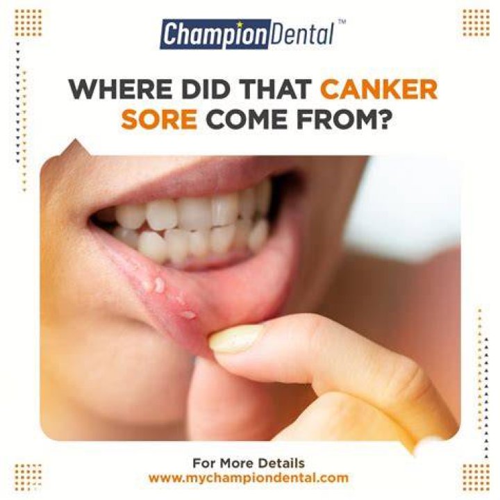 Can dental work cause sore tongue?