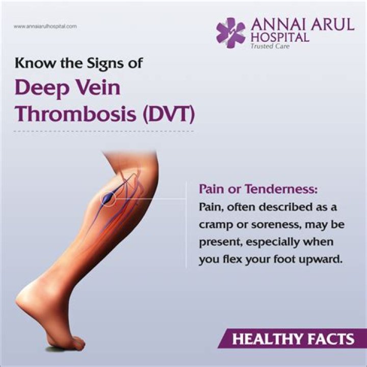 Can I sue for DVT?