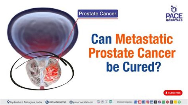 Can metastatic prostate cancer be cured?