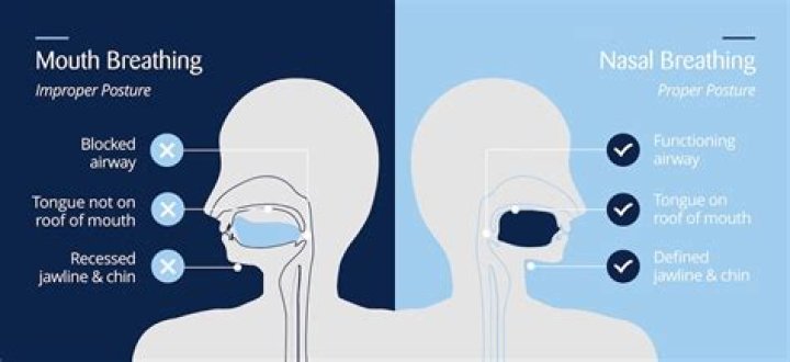 Can mouth breathing cause a blocked nose?
