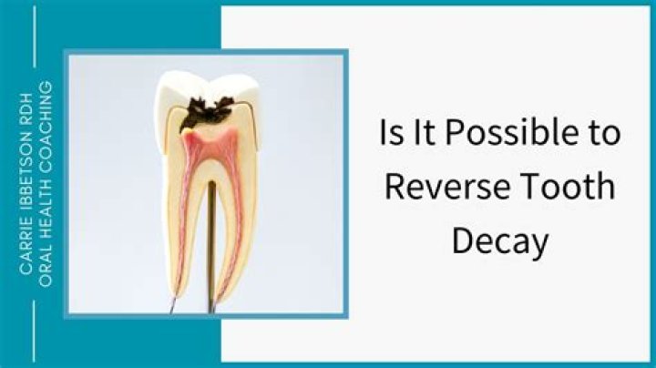 Can xylitol reverse cavity?