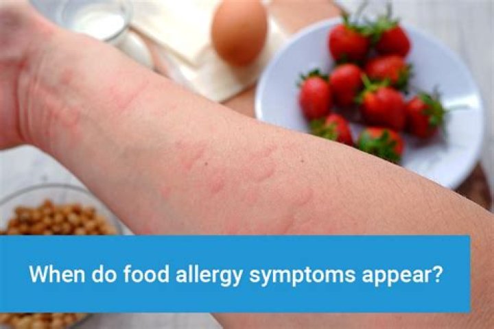 Can you be allergic to millet?