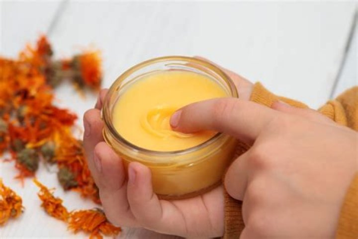 Can you use calendula cream on kids?