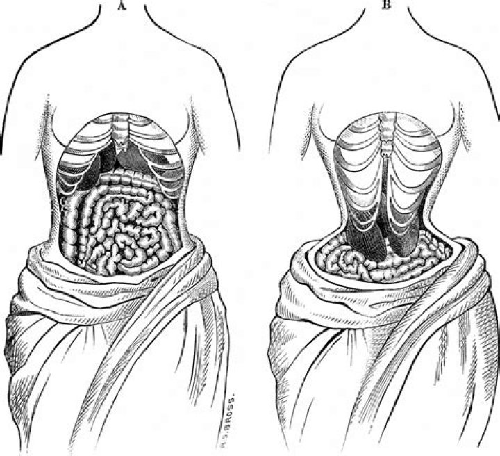 Do corsets train your waist to be smaller?