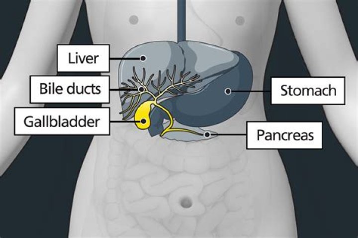 Does a high functioning gallbladder need to be removed?