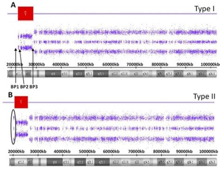Does microarray test for Prader-Willi?
