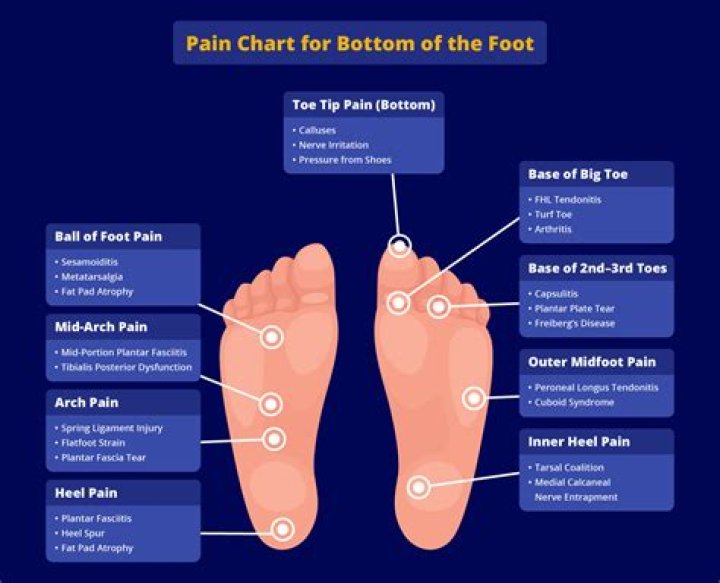 How do I stop the bottom of my feet from hurting when I run?