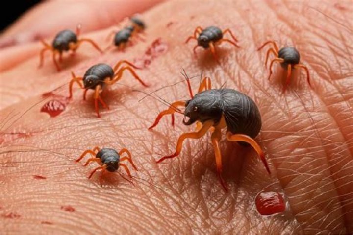 How do you get rid of mange mites on humans?