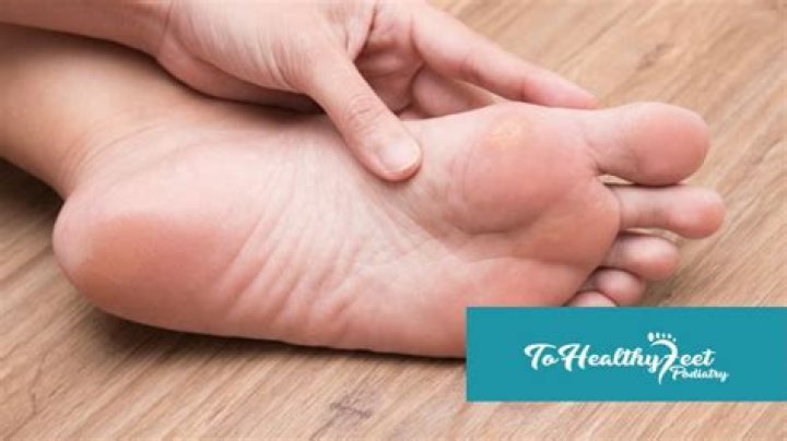 How do you treat a rash between your toes?