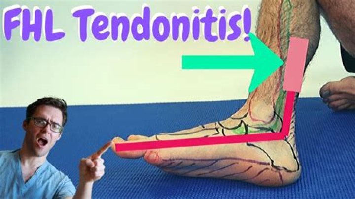 How do you treat extensor hallucis longus pain?
