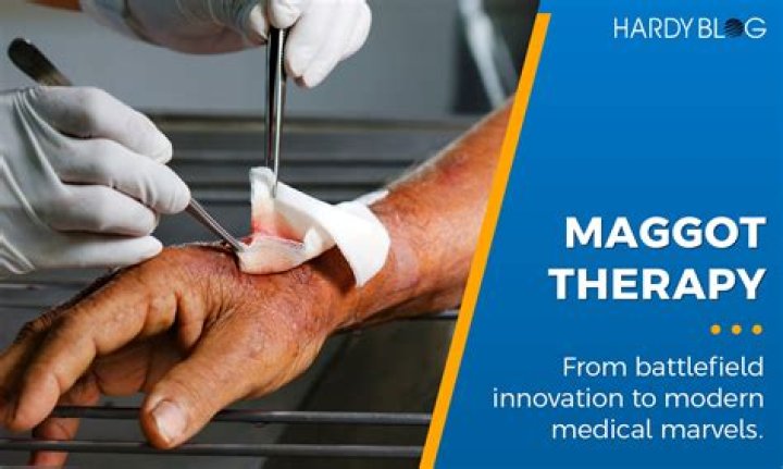 How do you treat maggot wound infestation?