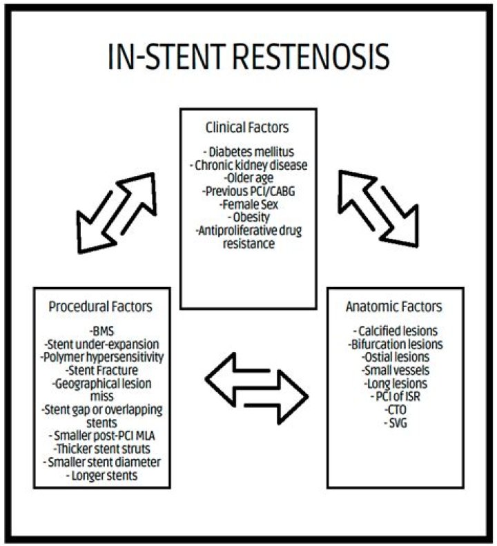 How is stent restenosis treated?