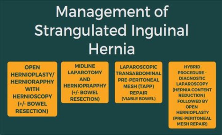 How long can you survive with a strangulated hernia?
