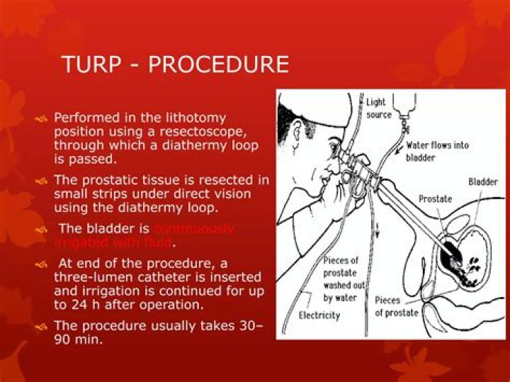 How long does a TURP procedure take?