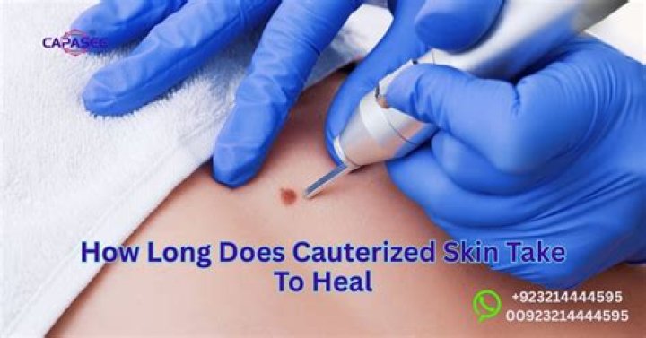 How long does cauterized skin take to heal?