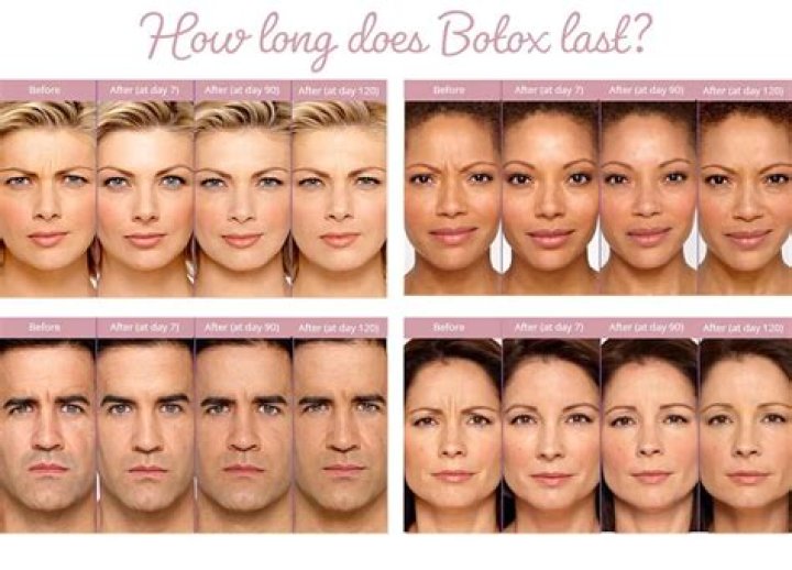 How long does it take to see results from Obagi?