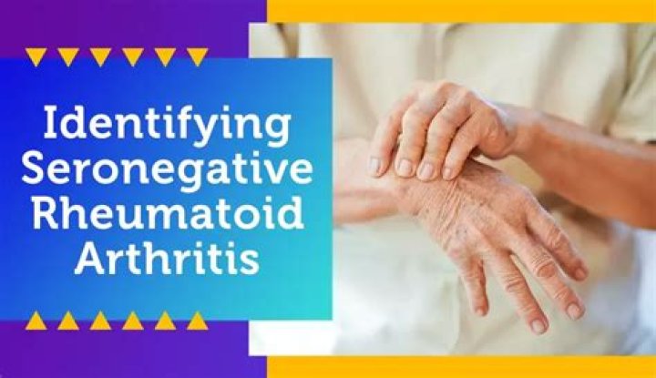 How serious is seronegative rheumatoid arthritis?