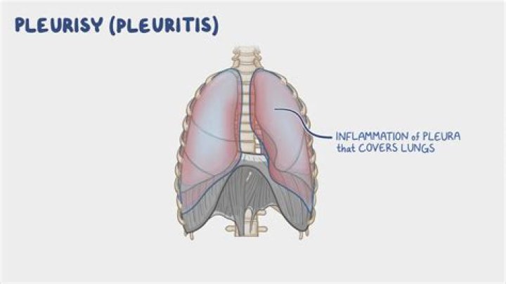 How would you describe pleural rub?