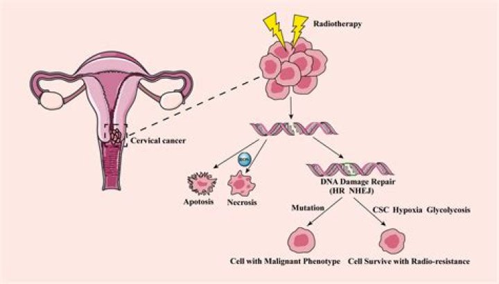 Is abortion linked to cervical cancer?