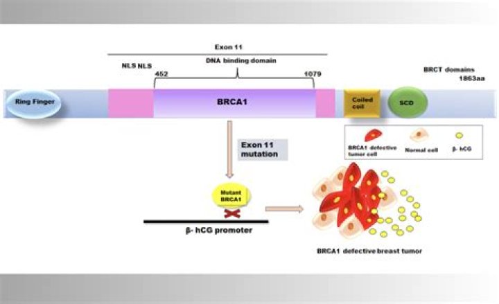 Is BRCA1 related to breast cancer?
