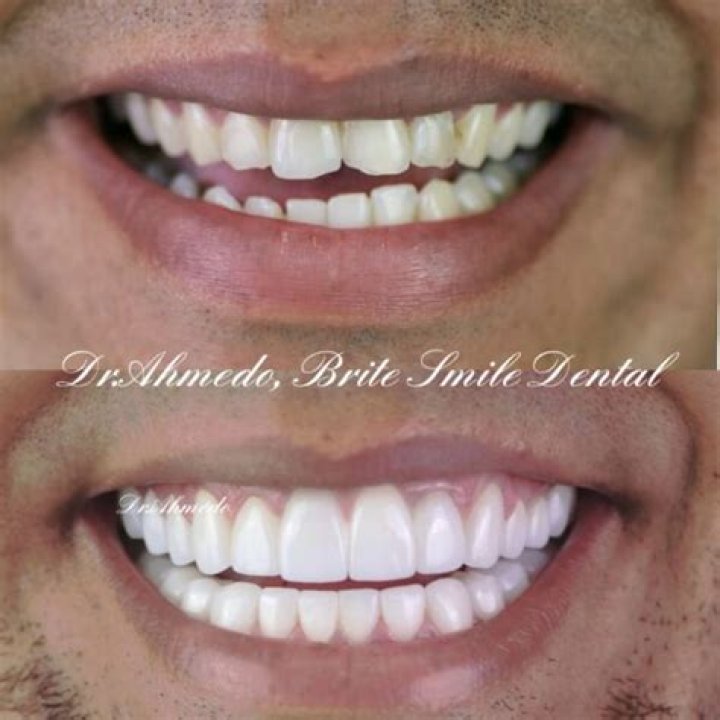 Is Brite smile still in business?