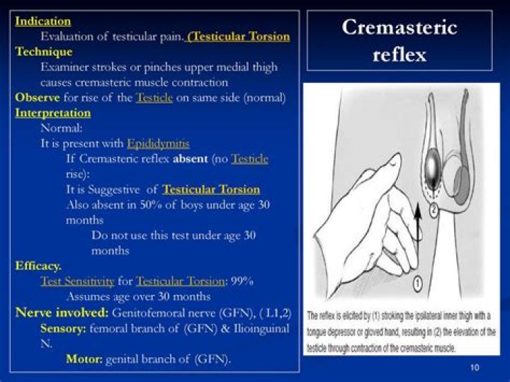 Is Cremasteric reflex present in testicular torsion?