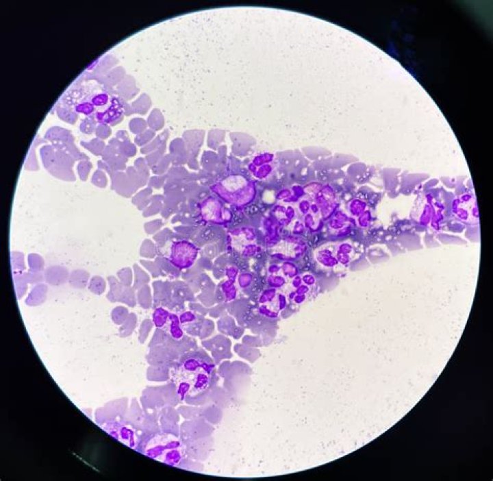 Is FuGENE toxic to cells?