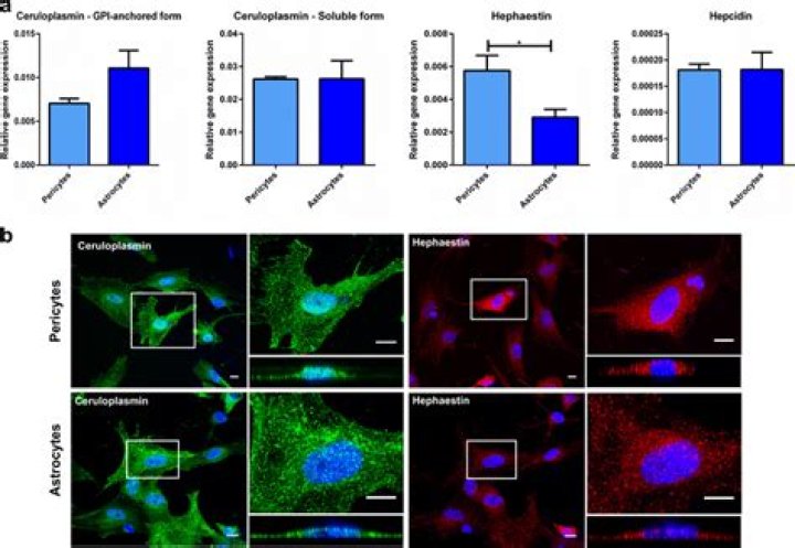 Is hephaestin same as ceruloplasmin?