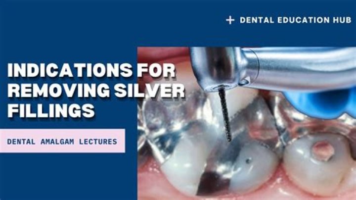 Is it worth removing amalgam fillings?
