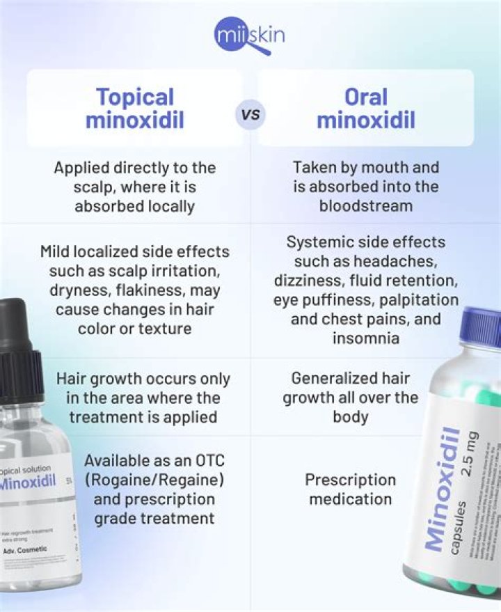 Is minoxidil legal in UK?