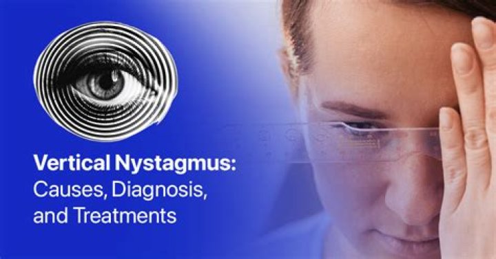 Is nystagmus a symptom of vertigo?