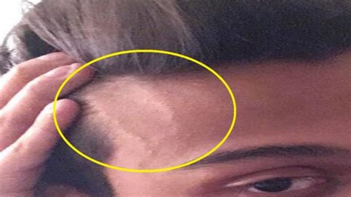 Is popping your head bad?