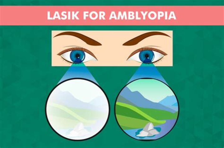 Is there surgery for refractive amblyopia?