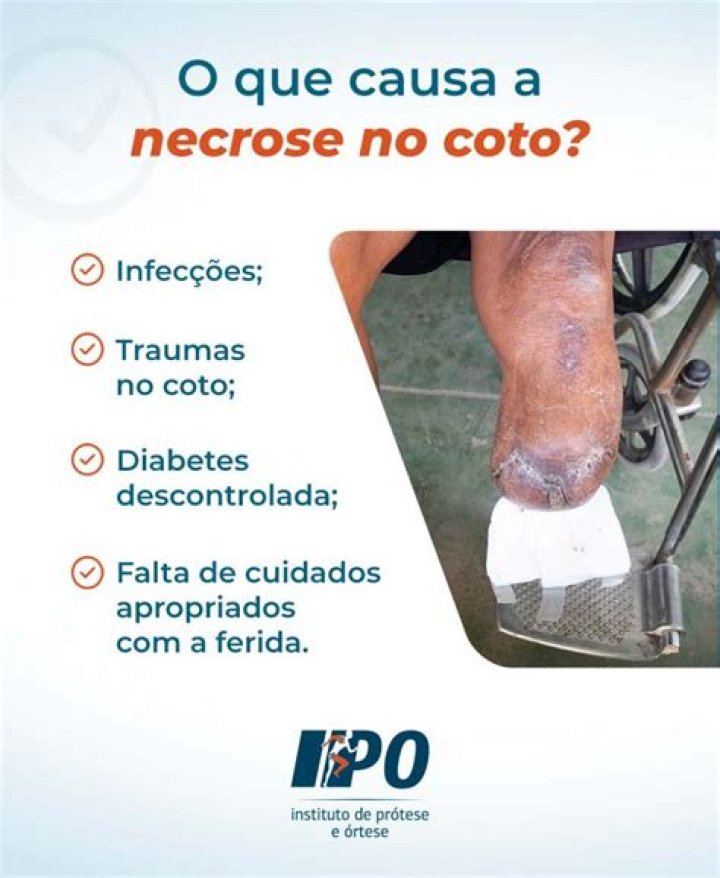 Por que a necrose pode ser eliminada?
