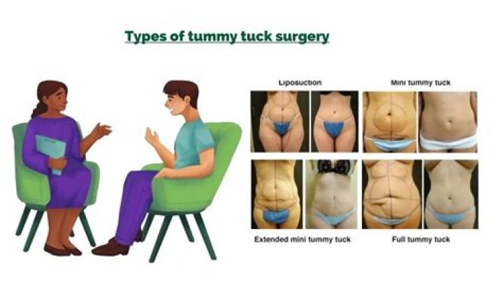 Should a 60 year old get a tummy tuck?