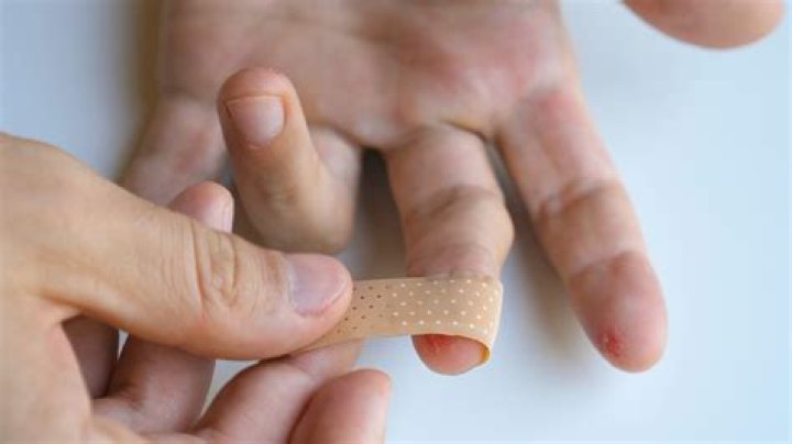 What are knuckle bandages used for?