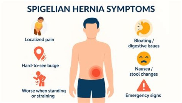 What are the symptoms of a Spigelian hernia?