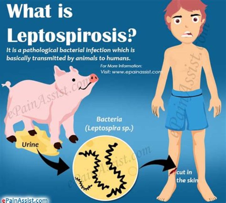 What bacteria causes Leptospira?
