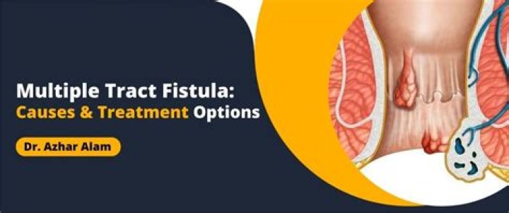 What causes fistula recurrence?