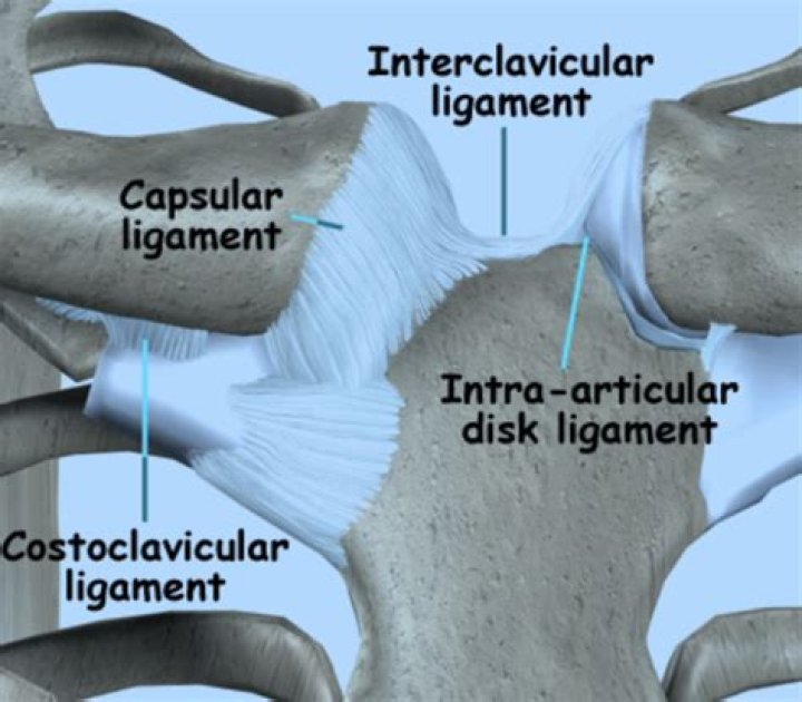 What causes sternoclavicular joint lump?