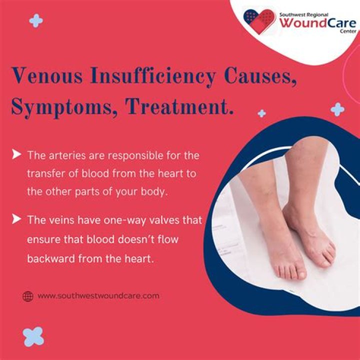 What causes venous insufficiency?