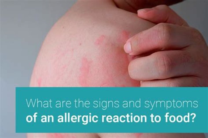 What does a food allergy rash look like?