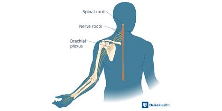 What does an injury to the brachial plexus feel like?