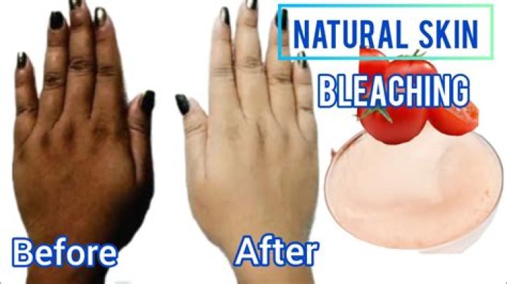 What does bleach do to black skin?