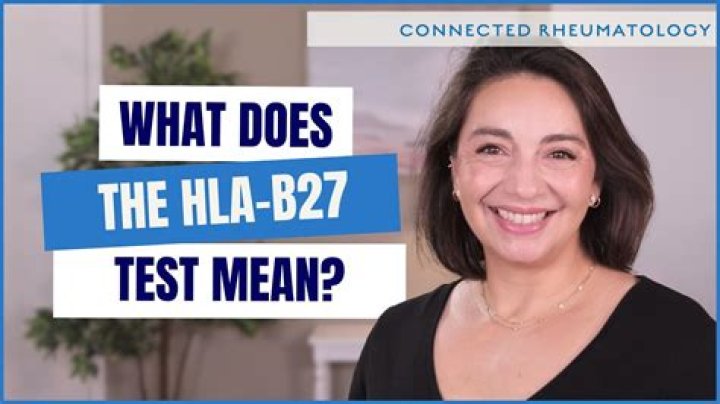 What does it mean if you test positive for HLA-B27?