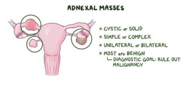 What does no adnexal mass mean?