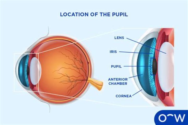 What does ovoid pupil mean?