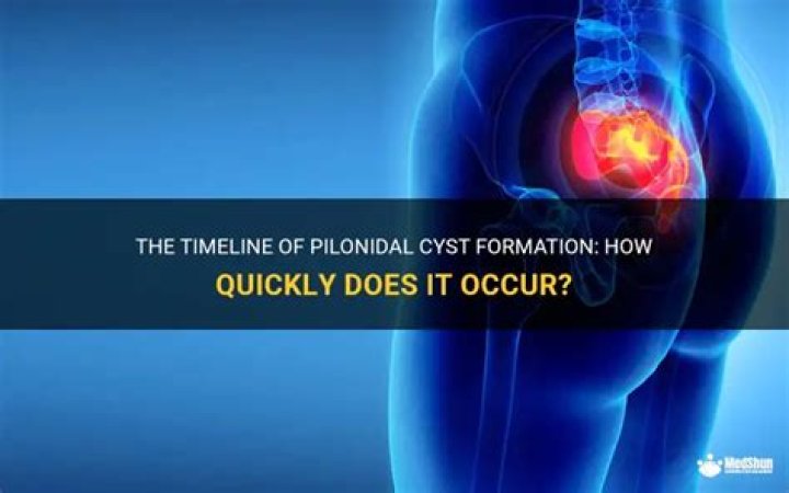 What does pilonidal cyst look like?