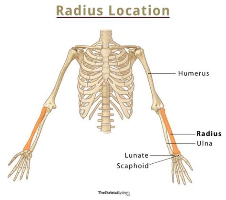 What does Radius Health do?