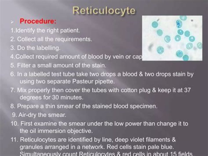 What does reticulocyte mean?